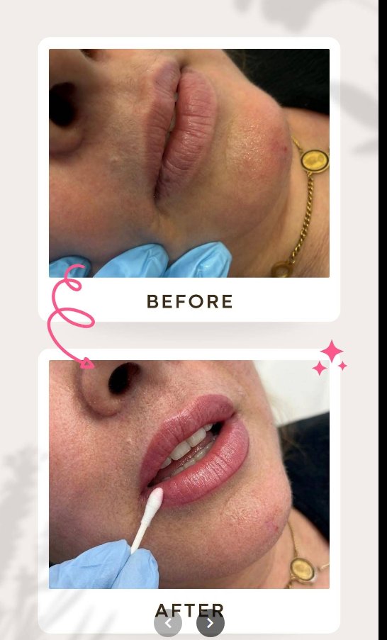 Lip Blushing Vorher Nachher